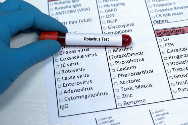 Im Kreis Lippe gab es im ersten Halbjahr 2025 bereits 113 Rotavirus-Infektionen. Foto: AOK/Colourbox/hfr